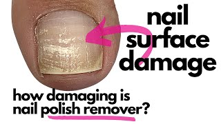 How Damaging Is Nail Polish RemoverAcetone Surprise Surprise [upl. by Lohman202]