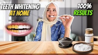 Teeth Whitening At Home  Guaranteed Results  No More Yellow Teeth  Dietitian Aqsa [upl. by Ttebroc]