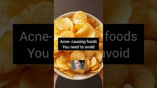 Acne Causing Foodsshorts [upl. by Eytak]