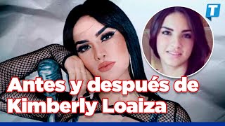 Kimberly Loaiza El antes y después de sus cirugías [upl. by Aserahs]