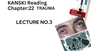 KANSKI Reading Chapter  22 TRAUMA 3 [upl. by Etat777]