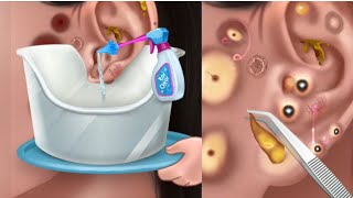 ASMR Ear piercing cleaning and pimple popping ASMR 耳ピアスのクリーニングとにきびのポッピング  asmr world [upl. by Shiri]