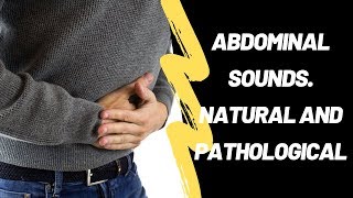 Abdominal Sounds Natural And Pathological [upl. by Atilef]