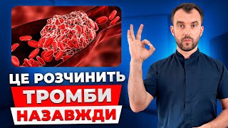 Як врятувати себе від тромбів Зробіть це і тромби пройдуть назавжди [upl. by Enylhsa303]