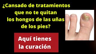 ¿Cansado de tratamientos que no te quitan los hongos de las uñas Aquí tienes la curación [upl. by Haymo]