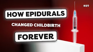 Epidural Everything You Need to Know [upl. by Porush442]