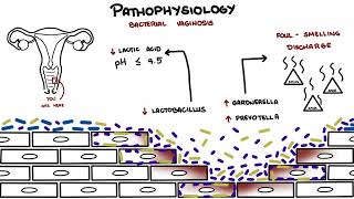 Bacterial Vaginosis [upl. by Germayne]