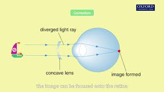 Animation 155 Short sight and long sight [upl. by Candide347]