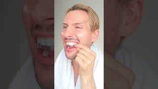 Whitening Teeth at Home Crest 3D Whitestrips teethwhitening whiteteeth shorts [upl. by Bohon57]