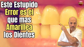 🆘 ESTE ESTUPIDO ERROR ES EL QUE MAS PONE LOS DIENTES AMARILLOS 🆘 [upl. by Collbaith796]