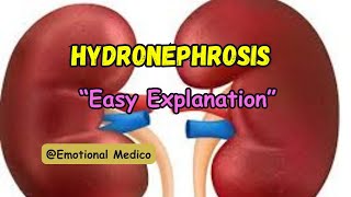 Hydronephrosis  Renal pathology mediumrobbins emotionalmedico [upl. by Riocard]