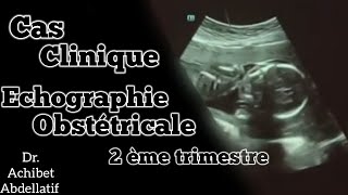 Formation  Échographie Obstétricale 2 ème trimestre Dr Achibet Abdellatif [upl. by Zoubek193]