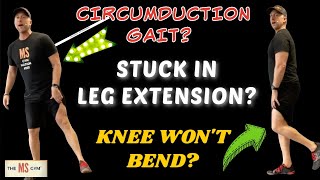 MULTIPLE SCLEROSIS EXERCISE  Circumduction Gait Knee Hyperextension This Exercise Is For YOU [upl. by Kemeny]