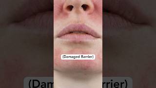 Skin Barrier Strengthening  How to Guide [upl. by Xenos]