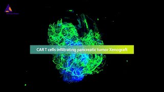 Revolutionizing the monitoring of CAR T cell therapies against solid tumors with the 3D imaging [upl. by Pickford]