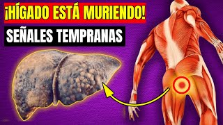 🚨 ¡8 Signos de que Tu Hígado ESTÁ MURIENDO ¡NO LAS IGNORES 🚨 [upl. by Vinny]