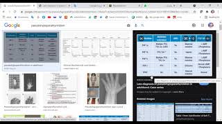 MRCP PART TWO PASSMEDICINE 2020 Endocrinology 72 [upl. by Hgielyak294]