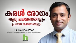 കരൾ രോഗത്തിന്റെ ഈ ലക്ഷണങ്ങൾ സൂക്ഷിക്കുക  Liver Disease Malayalam Health Tips [upl. by Kamp]