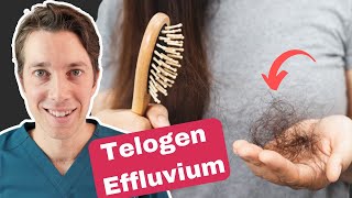 Telogen Effluvium Explained  Best Hair Shedding Treatments [upl. by Anor68]