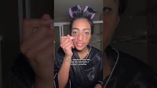 GRWM scalp eczema  eczema scars [upl. by Aneetsirhc]