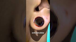 How Ear Gauges Can Tear Your Ears 👂 [upl. by Felty573]