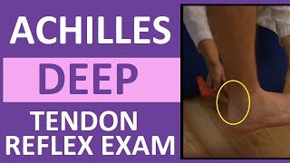 Achilles Heel Deep Tendon Reflex Test  Nursing Head to Toe Assessment [upl. by Naesal825]