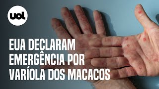 Varíola do macaco EUA declaram emergência sanitária [upl. by Kozloski19]