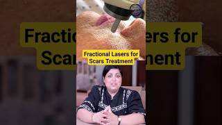 Laser Treatments for Face  Pimples and Acne Scar Laser Treatments laser resurfacing shorts [upl. by Niaz822]