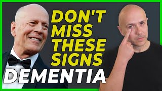 EARLY SIGNS OF DEMENTIA  HOW TO PREVENT DEMENTIA AND ALZHEIMER BRUCE WILLISS MENTAL DISEASE [upl. by Ralina]