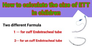 Endotracheal tube size calculation in children anaesthesiawithbabar2576 [upl. by Ricki]