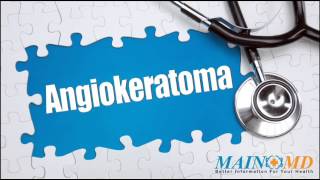 Angiokeratoma ¦ Treatment and Symptoms [upl. by Ielarol553]