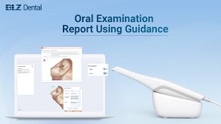 BLZ Dental Intraoral Scanner Oral Examination Report Using Guides [upl. by Nirag759]