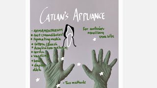 Catlans appliance removable appliance [upl. by Kyred]