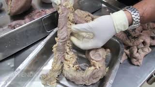 Anatomy Dissection of Large amp Small Intestine [upl. by Noseyt]