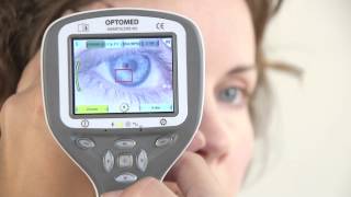 Optomed Smartscope PRO Anterior Imaging [upl. by Simah]