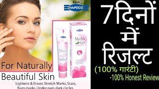 चेहरे के दाग  धब्बो और कालेपन के लिए  सिर्फ 7 दिनों में फर्क Marks Go Anti Marks Cream [upl. by Noyek725]