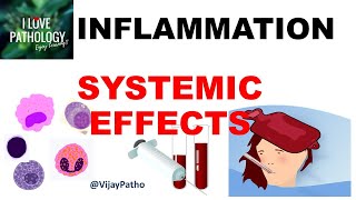 INFLAMMATION Part 10 Systemic effects of Inflammation [upl. by Conrado]