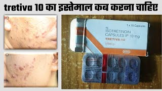 Tretiva 10 mg Capsule Uses  Isotretinoin Uses side Effects amp Dose In Hindi tretiva 10 mg benefits [upl. by Jonny]