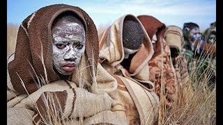 Male Circumcision in South Africa [upl. by Eurydice914]