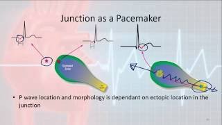 Basic Electrophysiology part 8  Junctional Rhythms [upl. by Aierbma]