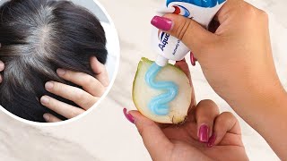 Remove Grey Hair Naturally Without Dyeing  Proven Method [upl. by Atekahs]