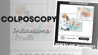 What is colposcopy  The diagnostic procedure Colposcope  Indication of colposcopy [upl. by Lydie]