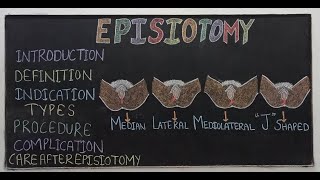 Nursing Course ∣ Live Class ∣ Episiotomy [upl. by Isolt]