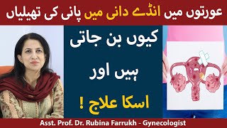 Anda Dani Ki Rasoli Ka Ilaj  Ovarian Cyst Signs And Symptoms In Urdu  Ovarian Cyst Kaise Thik Kare [upl. by Nirda446]