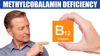 The 1st Sign of a Methylcobalamin B12 Deficiency [upl. by Auj]