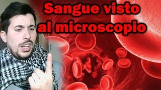 Il sangue visto al microscopio  I Globuli Rossi [upl. by Rfinnej]