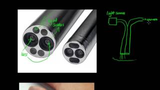 How Does an Endoscope Work  GCSE Physics [upl. by Amalia588]