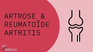 Artrose en Reumatoïde Artritis [upl. by Oryaj943]