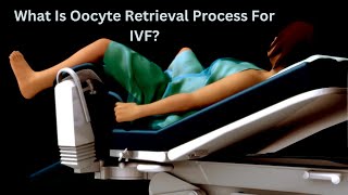 What Is Egg Retrieval Process For IVF  What is Oocyte Retrieval Process For IVF [upl. by Kareem846]