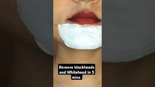 Remove blackheads and whiteheads within 5 mins shorts viralvideo hack makeuptutorial [upl. by Jahn]